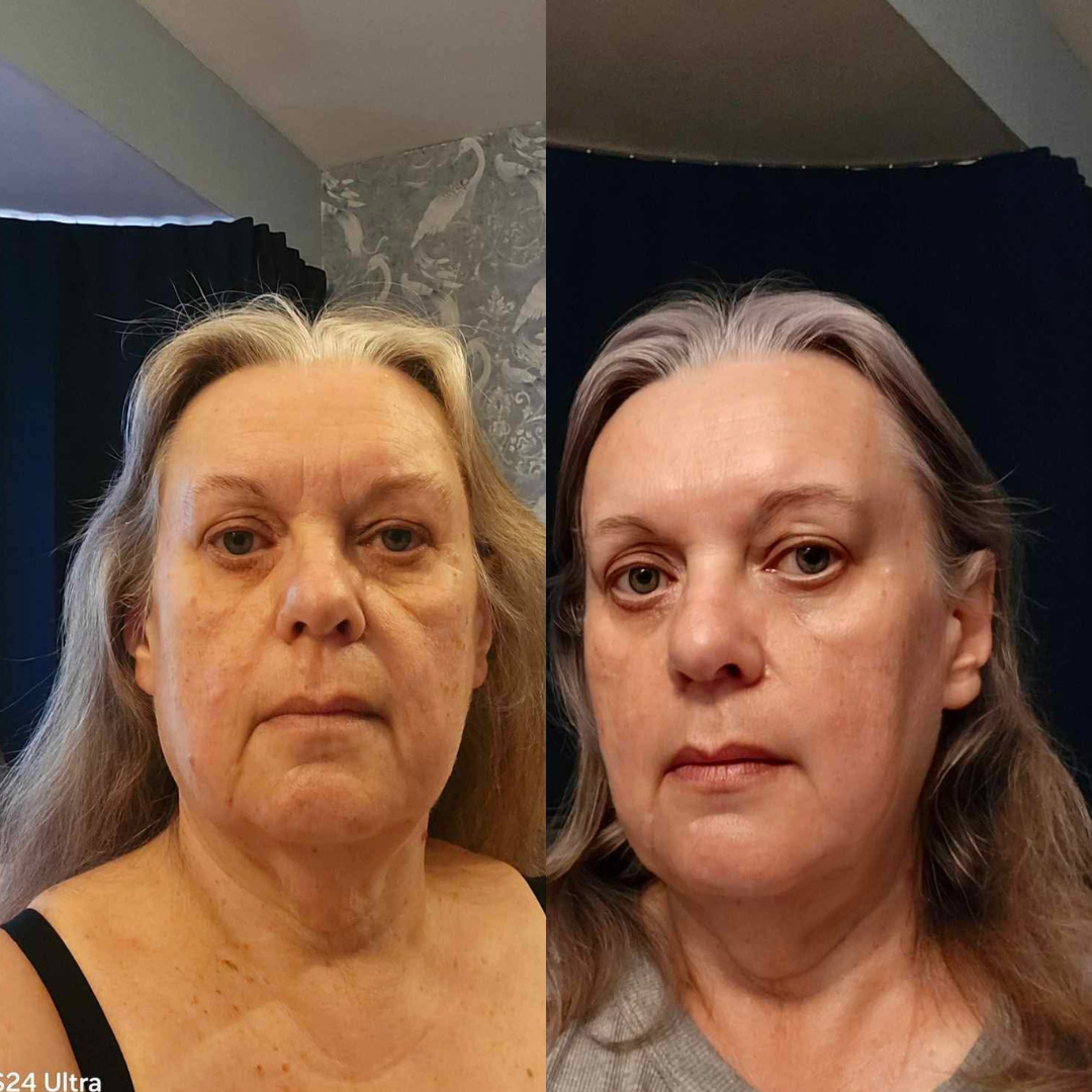 Review Anti aging serum