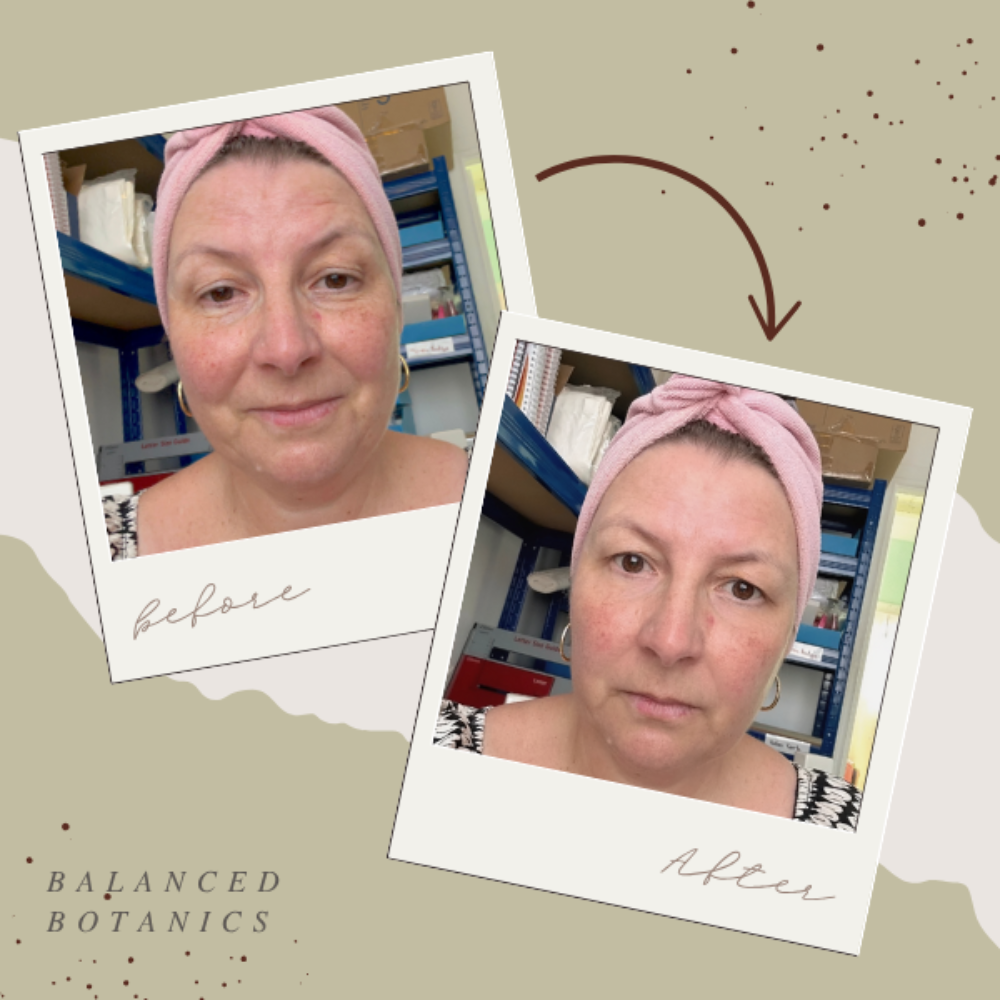 Before and after comparison of a woman wearing a pink headscarf with 'Balanced Botanics' branding.