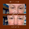 Before and after comparison of a woman's face with visible aging signs on a brown background.