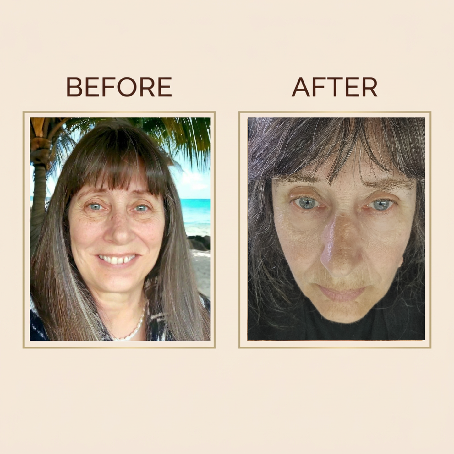 Revive Eye Complex for Puffiness & Dark Circles 15ml Wholesale Price: £45 | RRP: £68