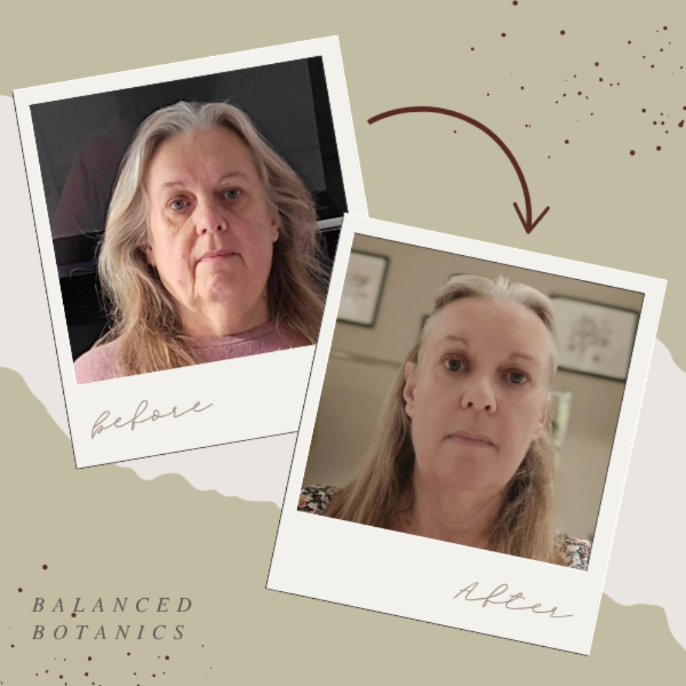 Before and after comparison of a person with text 'Balanced Botanics' on a beige background.