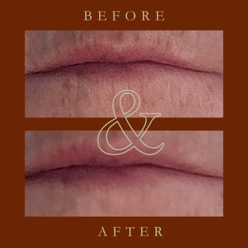 Before and after comparison of skin texture on a brown background