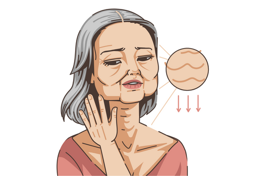 woman with saggy skin and wrinkles