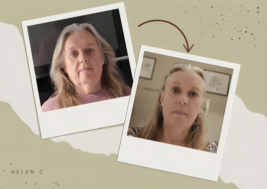 Real before and after