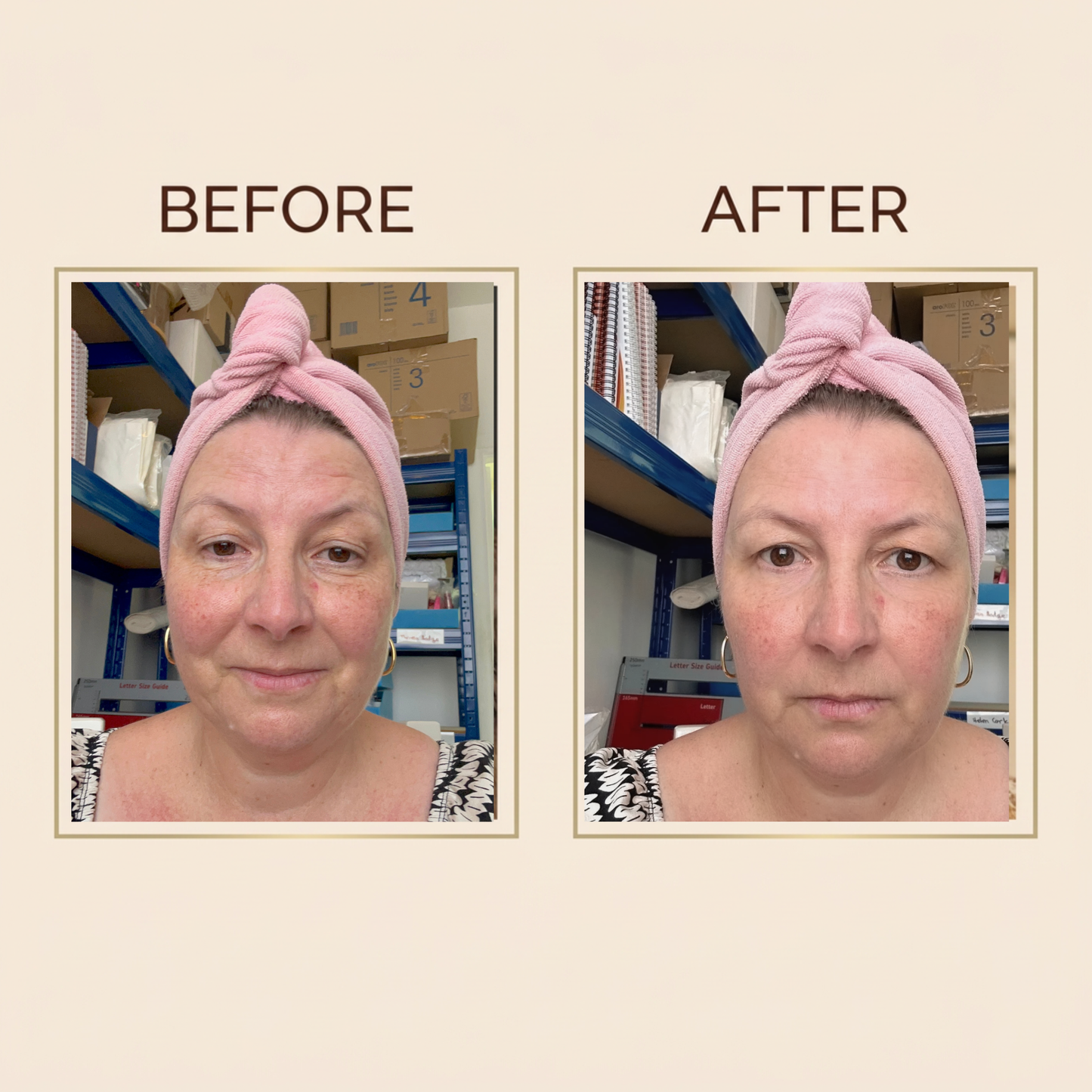 The Firm & Lift Face & Neck Care Collection