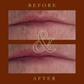 Before and after comparison of skin texture on a brown background
